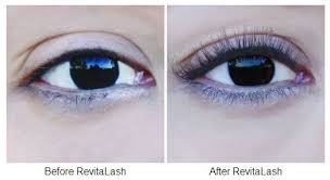 Revitalash And Revitabrow
