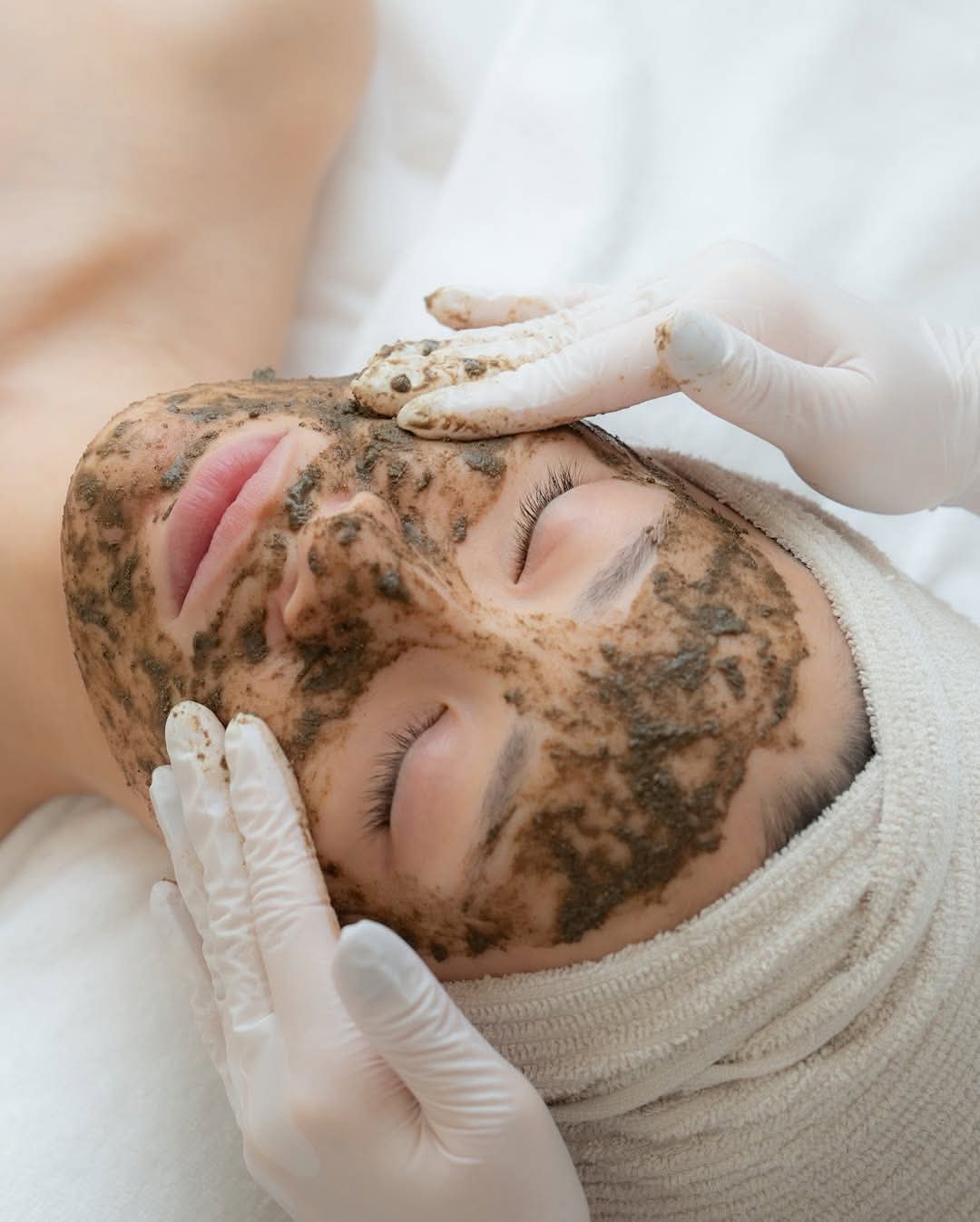 Chemical Peel Solana Beach 